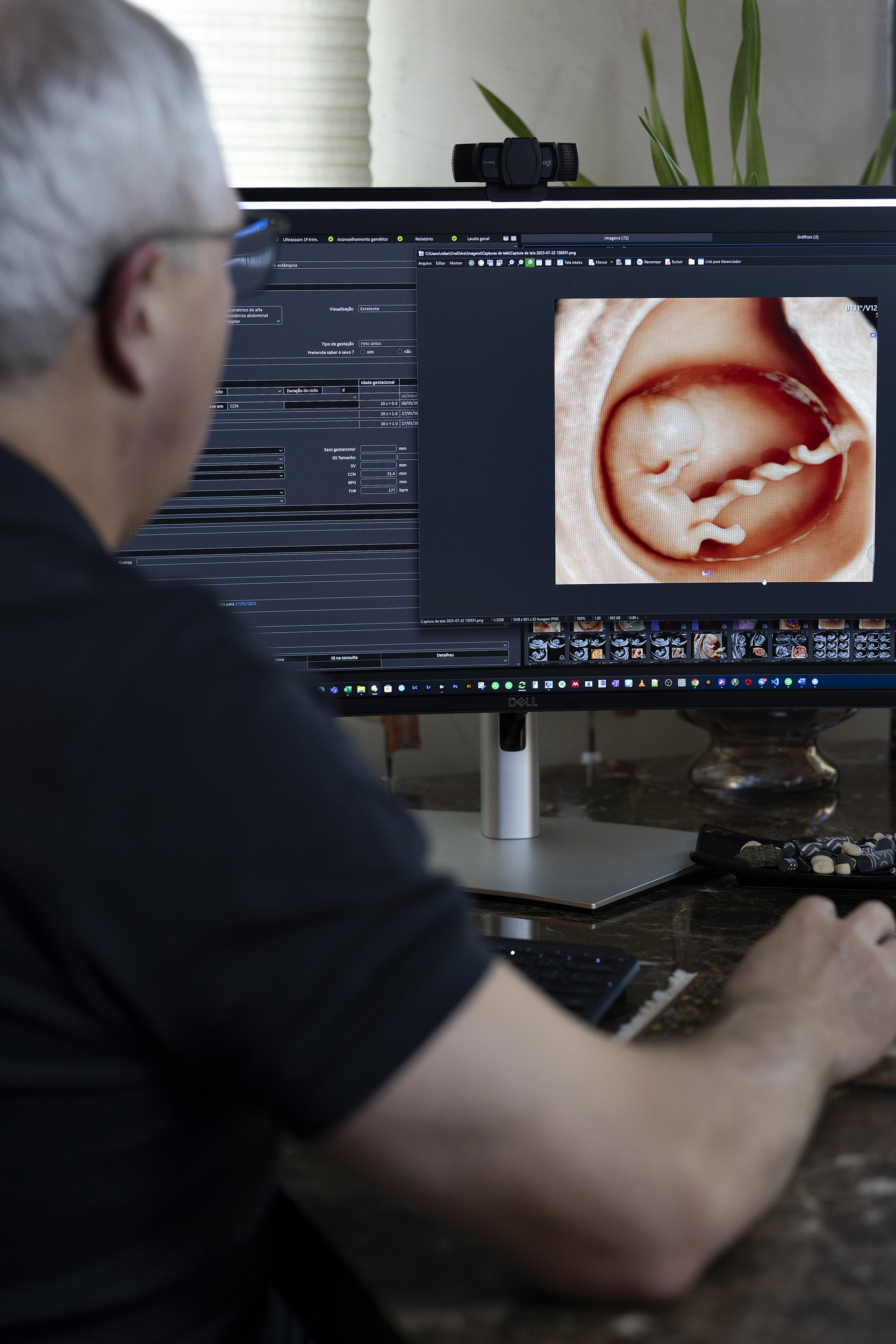 Foto de Ultrassonografia Obstétrica inicial