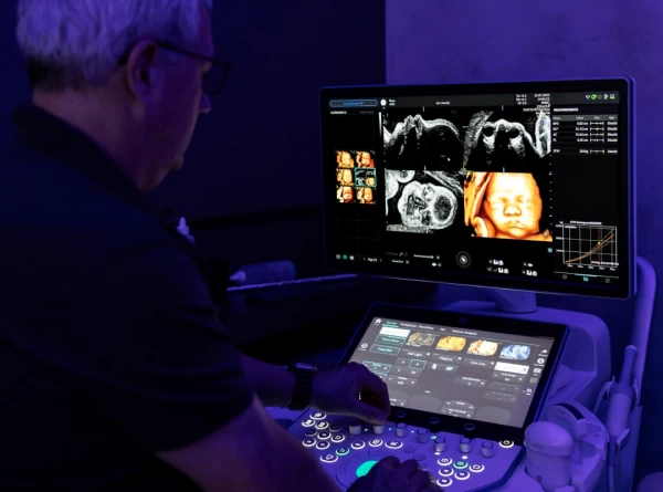 Imagem do post Ultrassom Morfológico de Primeiro Trimestre: O Que Está Por Traz das Imagens Fantásticas