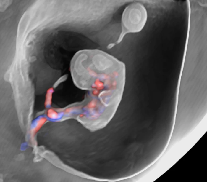 Imagem do serviço Ultrassonografia Obstétrica inicial