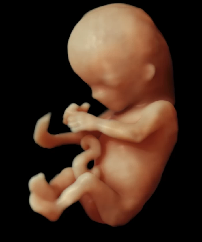 Imagem do serviço Ultrassonografia Morfológica de primeiro trimestre